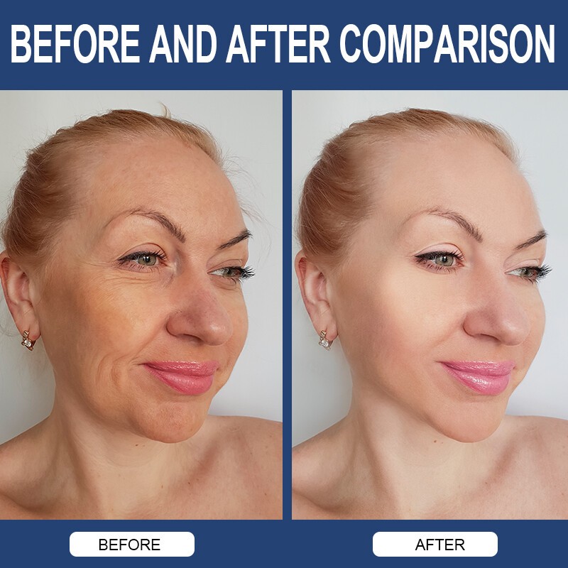850mg Hyaluronic Acid 30 mg of Vitamin C For Joint and Skin Health 1/2/4Bottles