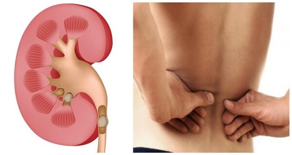 milk thistle extract – LIVER SUPPORT COMPLEX – weight loss supplement 1B