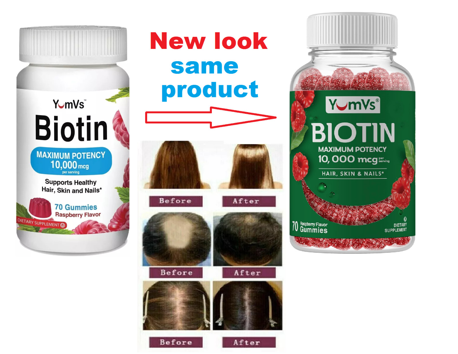 Gomitas de Biotina Vitaminas Para La Caida Del Cabello Evita La Perdida De Pelo