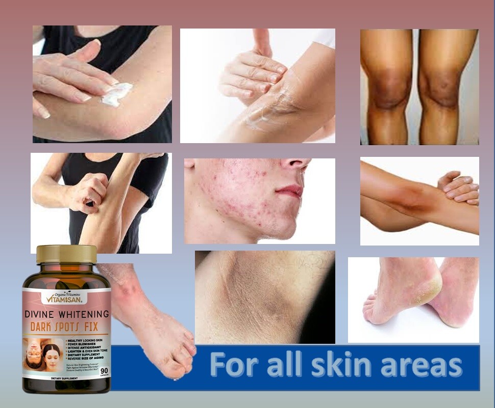 NAC Glutathione Skin Whitening Bleaching Anti-Agin Acne Scar & Dark Spot